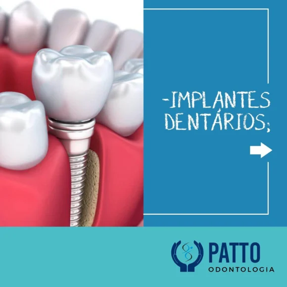 isiopatto_odontologia_img5